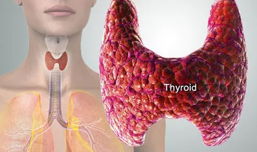 thyroid-disorders